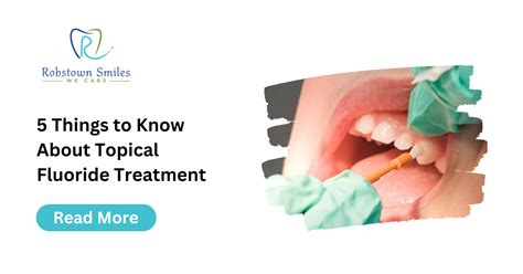 5 Things to Know About Topical Fluoride Treatment | Robstown Smiles