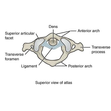 Atlas (C1) | Radiology Reference Article | Radiopaedia.org