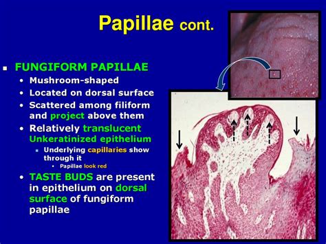 Introduction to the Oral Cavity and Periodontal Disease - online presentation