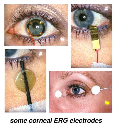 Electroretinography