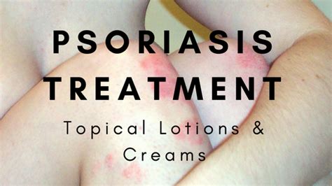 The Best Psoriasis Treatment – Topical Lotion and Cream : Reviews for 2017 - Premium Wellness