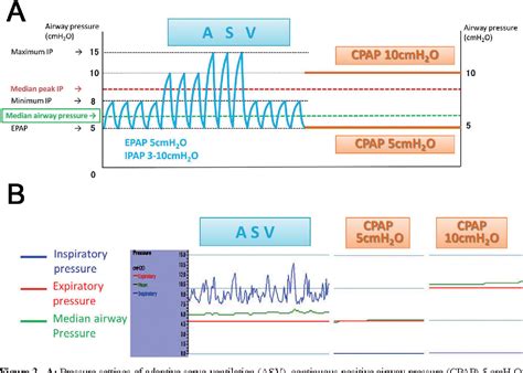 Figure 2 from Adaptive Servo-Ventilation Has More Favorable Acute Effects on Hemodynamics Than ...