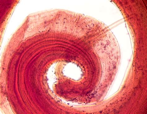 Trichuris trichiura | Medical Laboratories