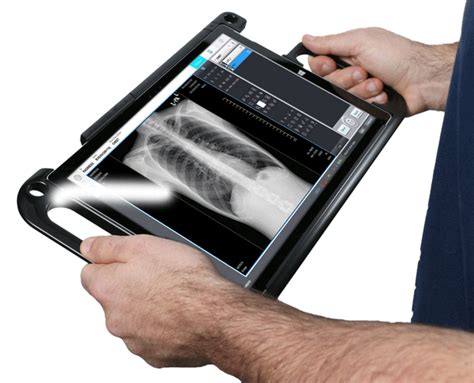 MinXray Portable X-ray System with Digital X-ray / DR Panel – MavenImaging