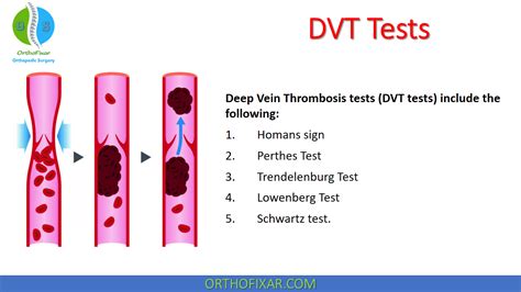 Orthopedic Special Tests 2023