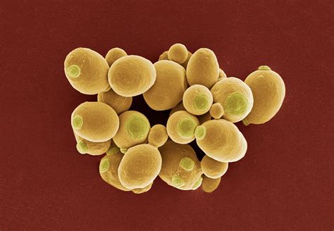 Genetically Modified Yeast Will Make It Possible to Home-Brew Opiates ...