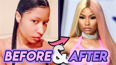 Nicki Minaj | Before and After Transformations | New Nose? Plastic Surgery Transformation - YouTube