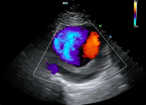 Ultrasound Physics and Technical Facts for the Beginner | Sonoguide