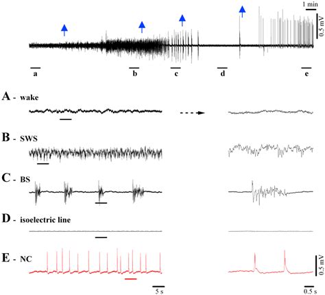 Dead or Alive? Rethinking the Flat Line EEG - Sapien Labs | Shaping the Future of Mind Health