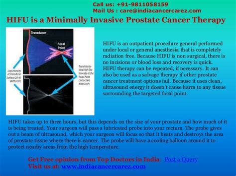 HIFU procedure for Prostate Cancer Treatment | Prostate Cancer Treatm…