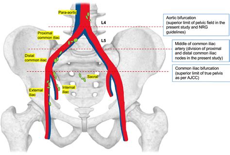 The Pelvic Veins External Internal Common Iliac Teach - vrogue.co