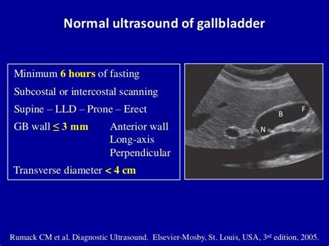 Ultrasound of the gallbladder | Ultrasound, Gallbladder, Sonography