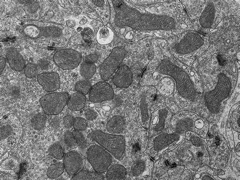 Mitochondria Electron Micrograph Labelled