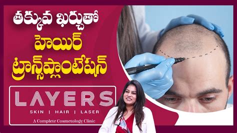 Hair Implantation at Layers Skin & Hair Clinic | Dr Suvidha Gandra MD Dermatologist - YouTube
