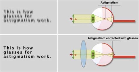 How Do Lenses for Astigmatism Work?