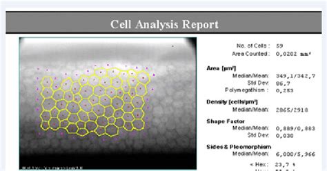 Illustration of the screen of a corneal specular microscopy (BioOptics ...