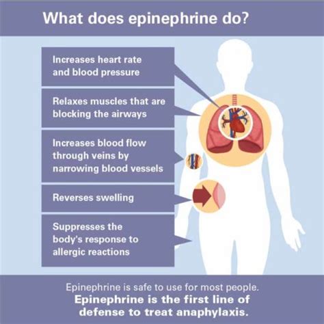 Anaphylaxis = Epinephrine: Treating a Severe Allergic Reaction