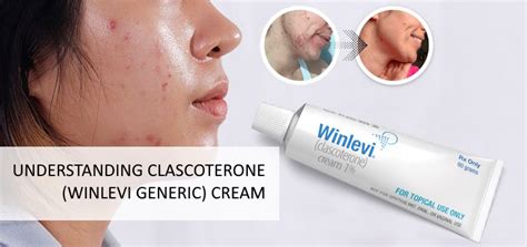 Understanding Winlevi Cream: Uses, Side Effects, and More