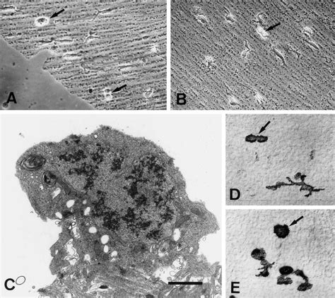 Mitotic ameboid microglial cells in the vitreal part of the developing... | Download Scientific ...