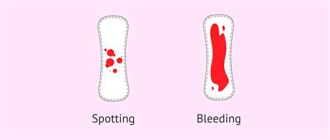 Is bleeding in pregnancy normal? What are the causes?