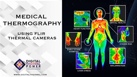 Medical Thermography using FLIR Thermal Camera - YouTube