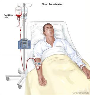 BLOOD TRANSFUSION: GOOD OR SINFUL? A BIBLICAL CLARIFICATION - Fr ...