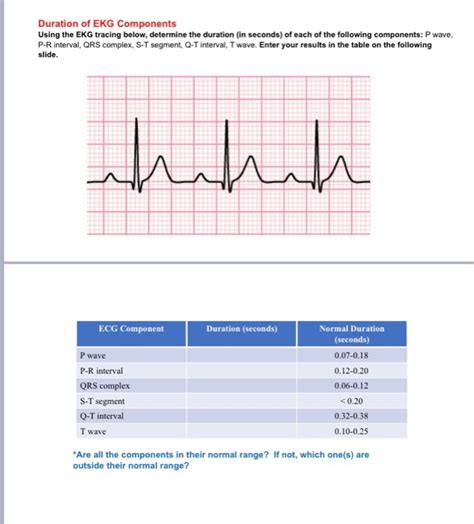 Solved Duration of EKG Components Using the EKG tracing | Chegg.com