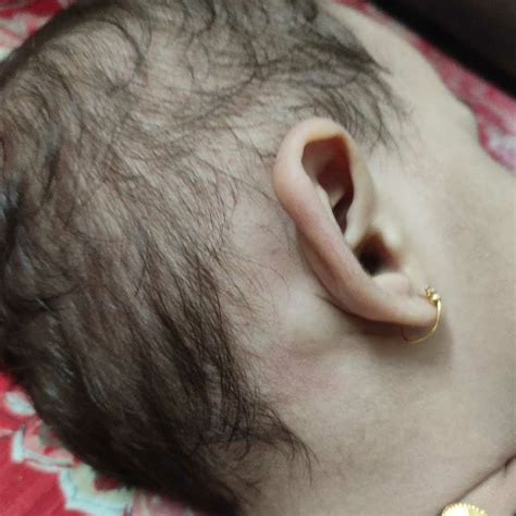 #AskTheExpert Hi there is a node/small lump behind my baby's ear. no pain till now, no redness ...