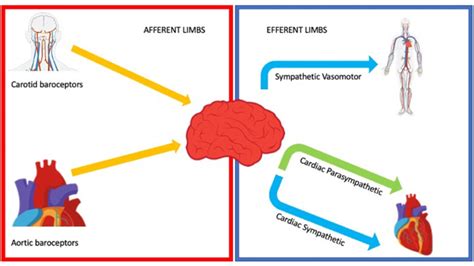 Vasovagal syncope: An overview of pathophysiological mechanisms - European Journal of Internal ...