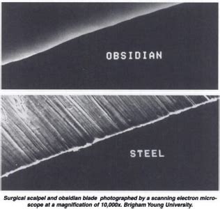 Obsidian scalpel electron microscope - lopershack