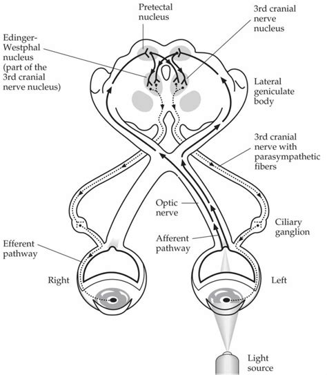 Pupillary light reflex & pupillary light reflex test