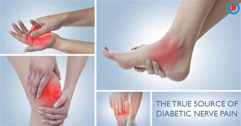 The Source of Diabetic Nerve Pain Finally Revealed! | Diabetes Health Page