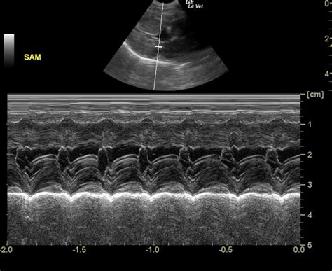 Mild systolic anterior motion (SAM) of the mitral valve in a 19 year old MN DSH cat - Members