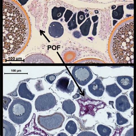 Progression of oocyte development from primary growth oocytes (PG), to... | Download Scientific ...