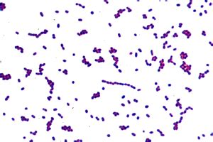 DM Lab 15 - Gram Stain Results