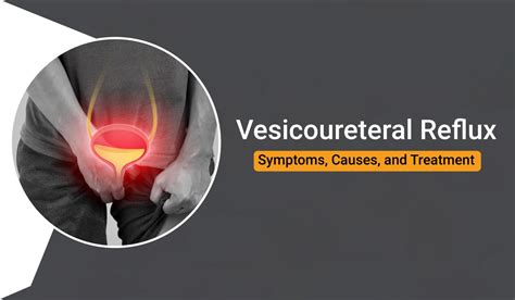 Vesicoureteral Reflux : Symptoms, Causes, and Treatment