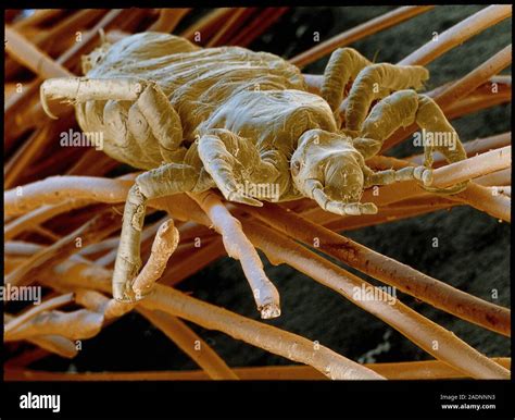 Head louse. Coloured scanning electron micrograph (SEM) of a blood-sucking human head louse ...