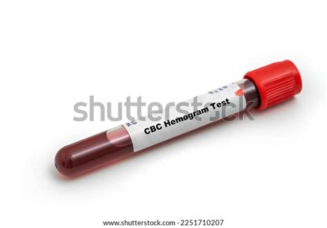 56 Hemogram Images, Stock Photos & Vectors | Shutterstock