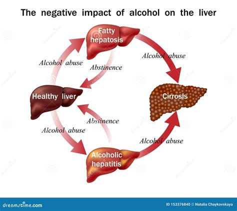 Effects On Liver From Alcohol