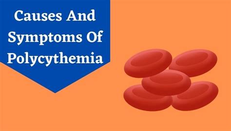 Polycythemia Vera Causes And Its Treatments