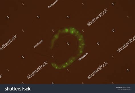 Caenorhabditis Elegans Expressing Gfp Under Microscope Stock Photo 1943819692 | Shutterstock