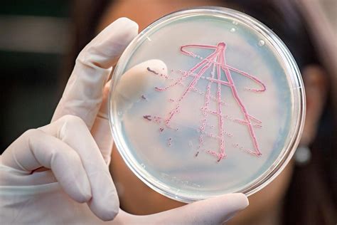 Unveiling the Science Behind Clostridium perfringens: Exploring Characteristics, Contamination ...