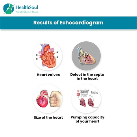 Echocardiogram: Types and Indications – Healthsoul