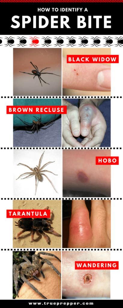 How to Identify a Spider Bite and Treat It - TruePrepper