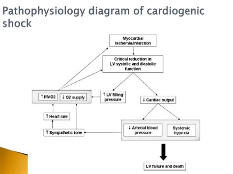 PPT - Cardiogenic Shock By Fritzanella Lafond PowerPoint Presentation, free download - ID:1540612