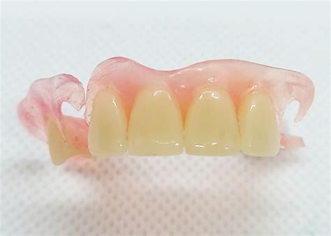 Flexible Partial Dentures – Dental Lab Direct