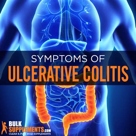 Ulcerative Colitis: Symptoms, Causes & Treatment