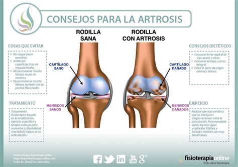 Artrosis como algo genérico - Qué es, causas, síntomas, tratamiento y ...