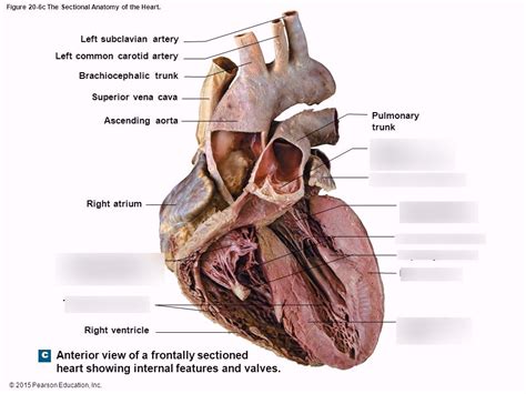 Heart cadaver Diagram | Quizlet