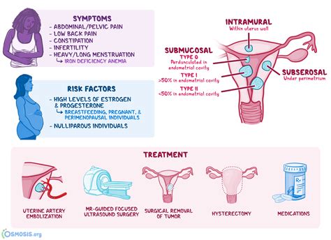 Leiomyoma of Uterus (Uterine Fibroid): What Is It, Causes, Types ...